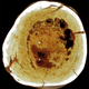 A cut-away of the bone. The spongy tumor is designated as (v). (Image: Edward J. Odes et al., 2016)